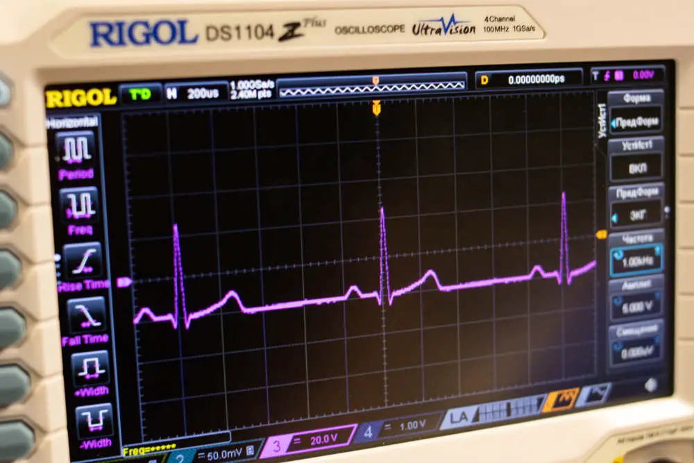 Oscilloscope vs logic analyzer: Rigol DS1104Z Plus Oscilloscope showing amplitude of the signals